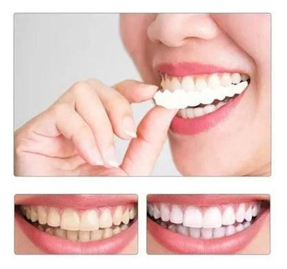CARILLAS DENTALES