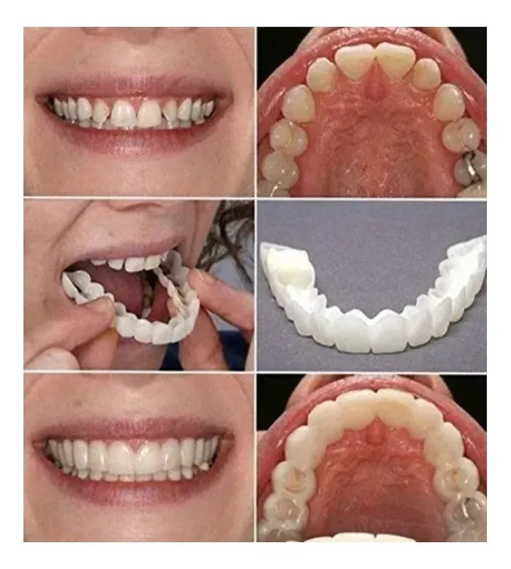 CARILLAS DENTALES