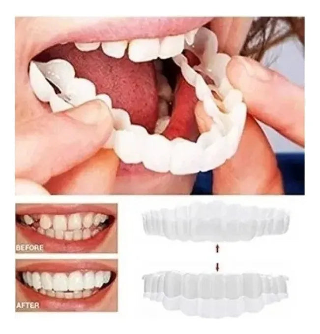 CARILLAS DENTALES