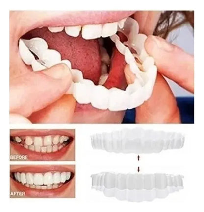 CARILLAS DENTALES