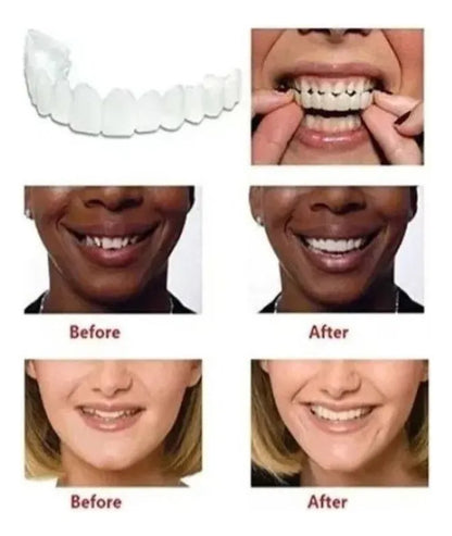 CARILLAS DENTALES